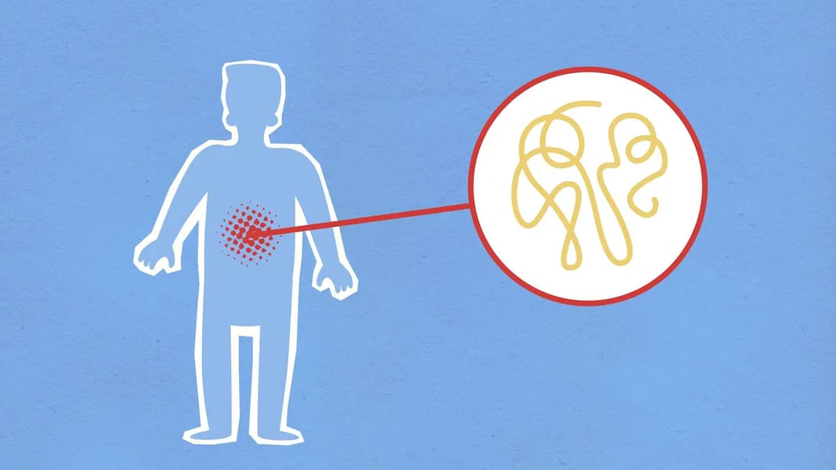 IBS & Digestive Issues — health condition