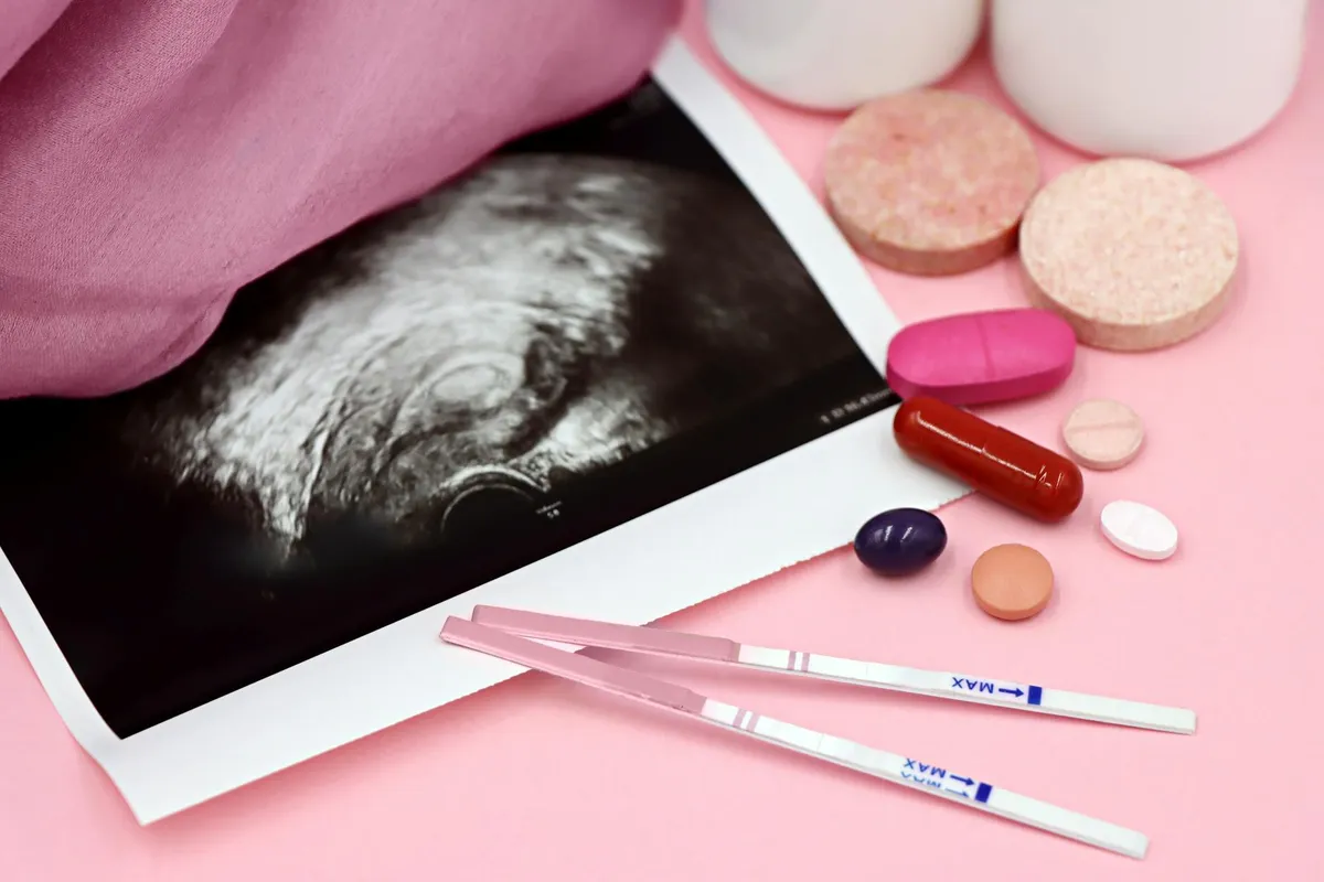 PCOS — health condition