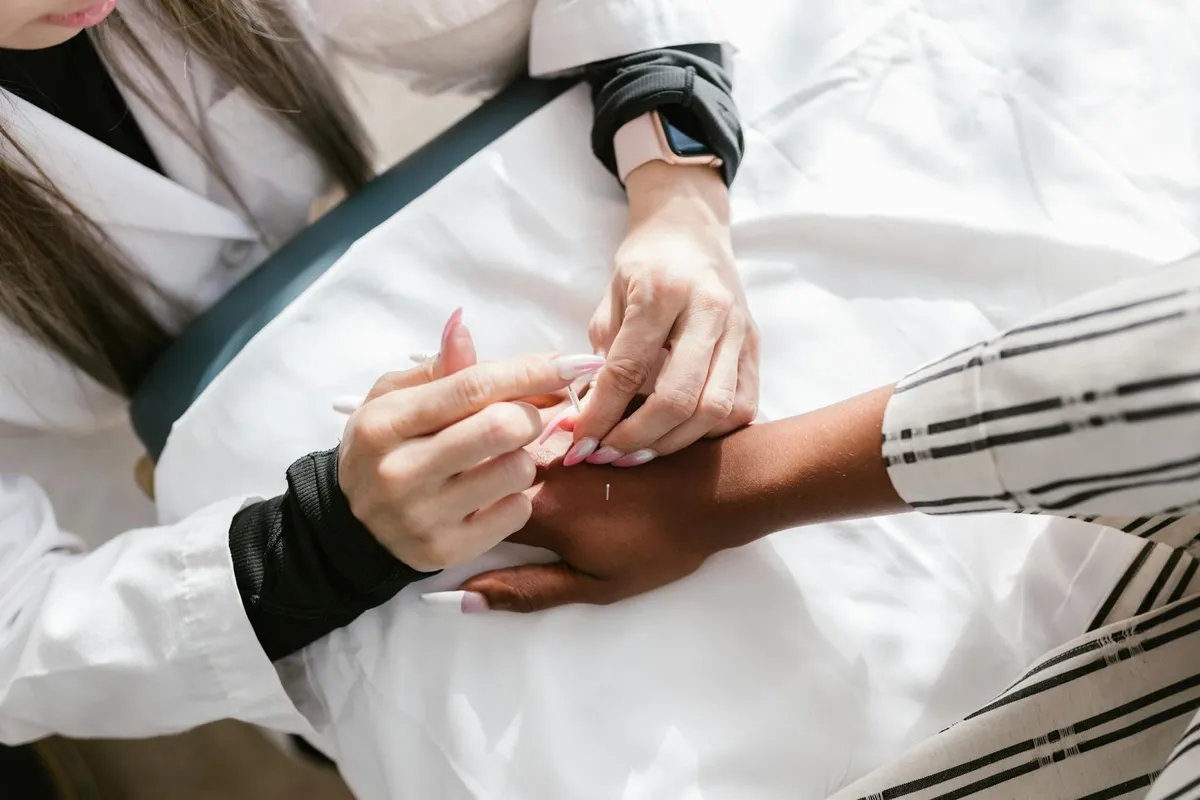 Acupuncture — Holistic health practice