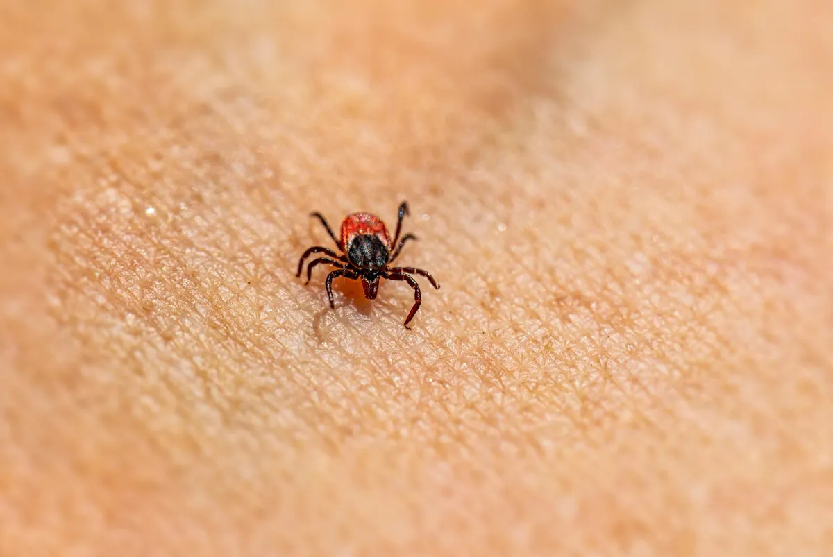 Irritation — health symptom
