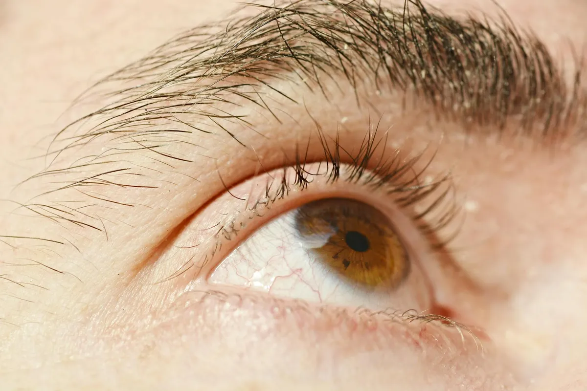 Itchy Eyes — health symptom