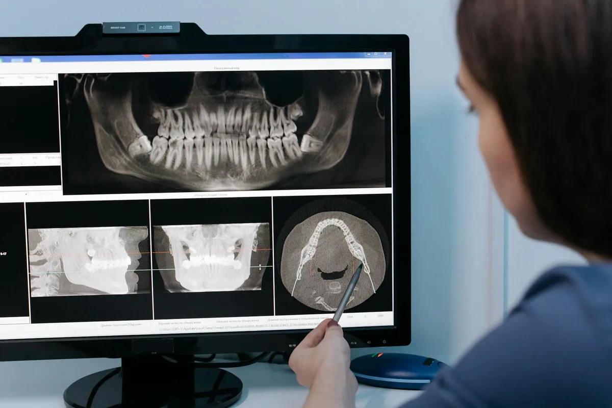 Jaw Clenching — health symptom