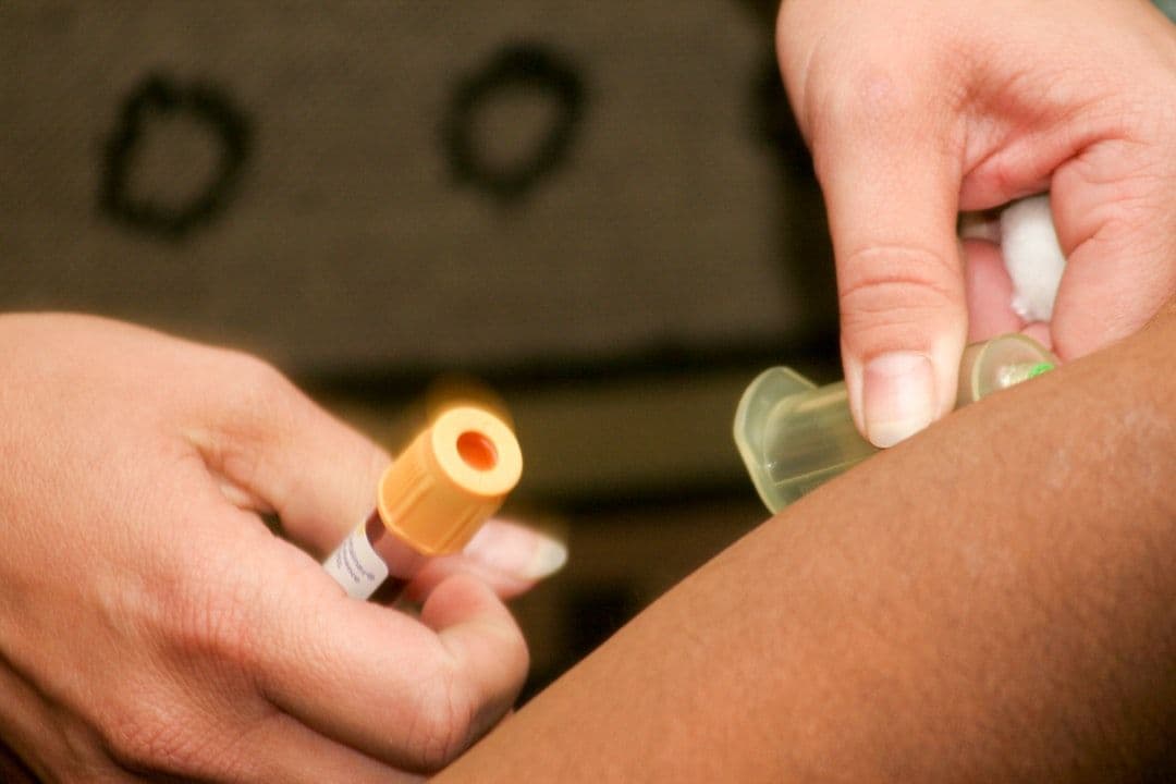Autologous Conditioned Plasma Therapy: Your Own Blood as Medicine — holistic health