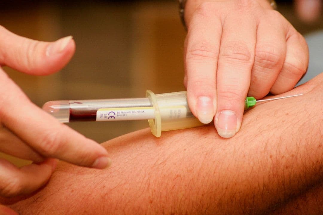 What Happens During an ACP Therapy Session: From Blood Draw to Injection — holistic health