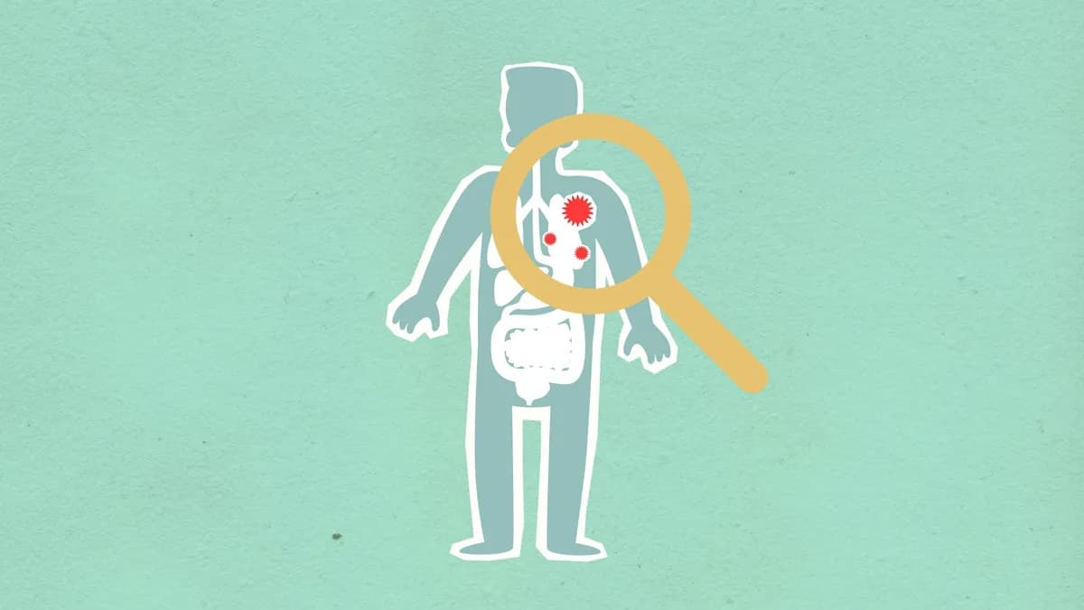 Autoimmune Conditions — health condition