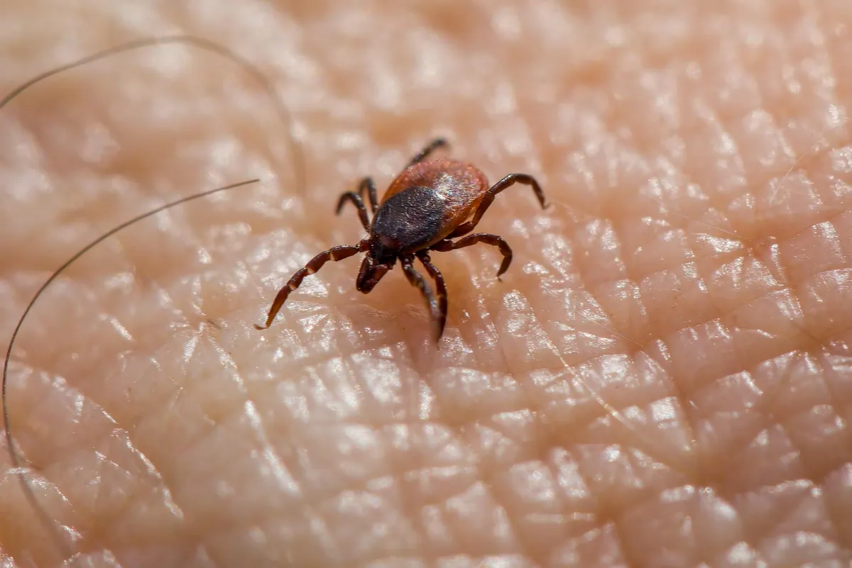 Lyme Disease — health condition