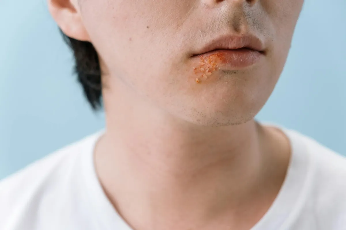 Skin Conditions — health condition