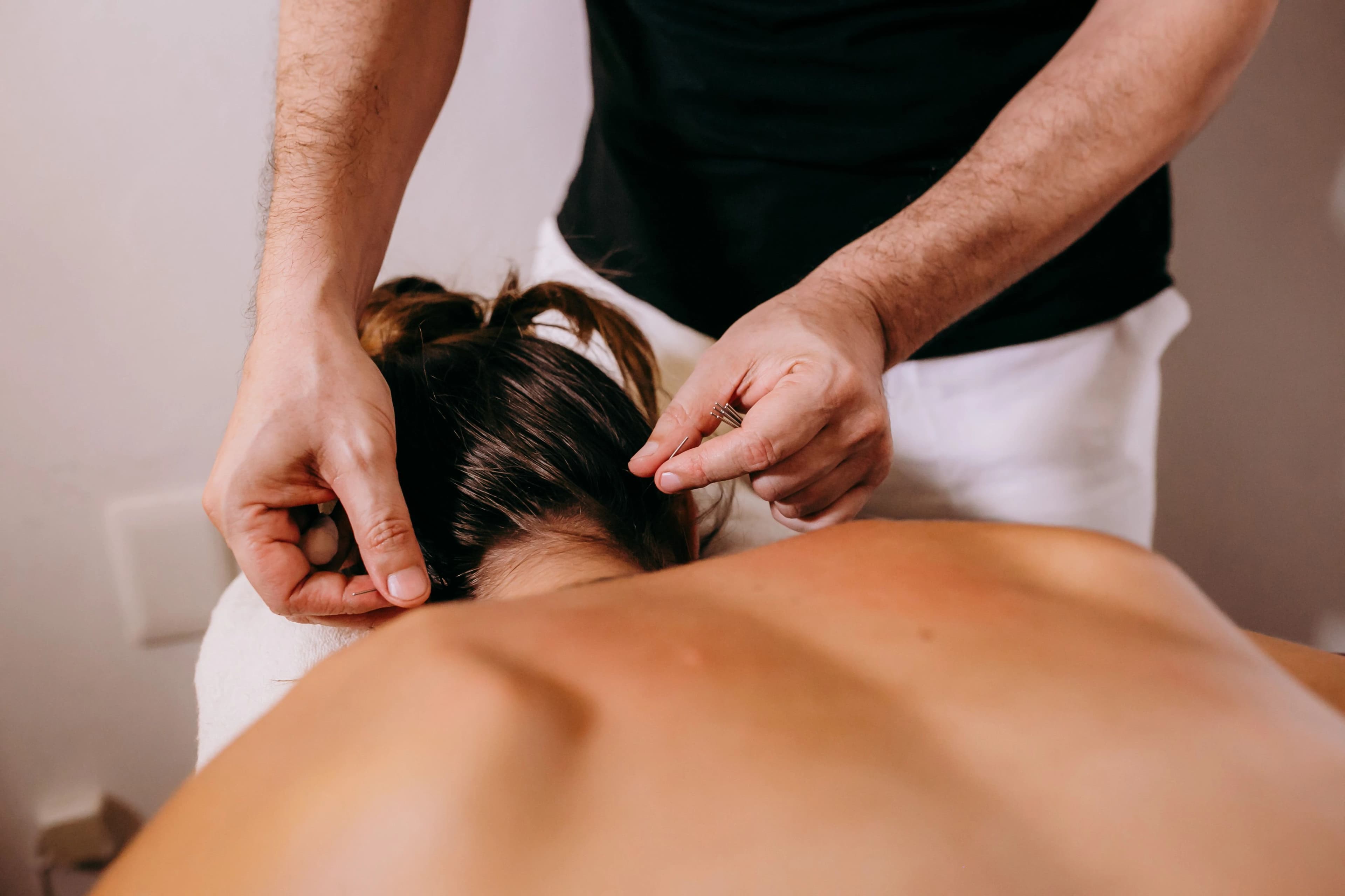 Dry Needling — Complementary health practice