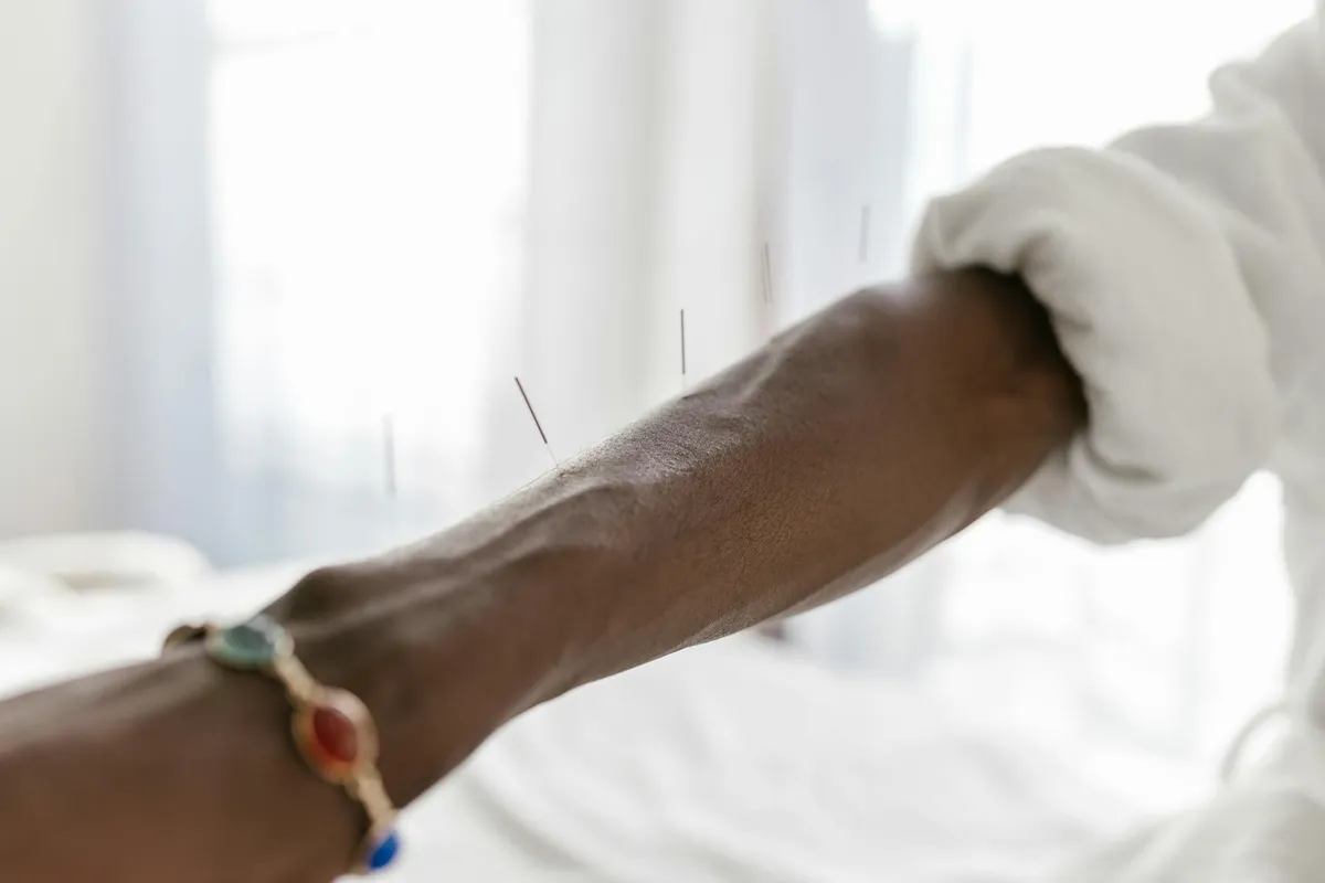 Marma Point Therapy — Alternative health practice