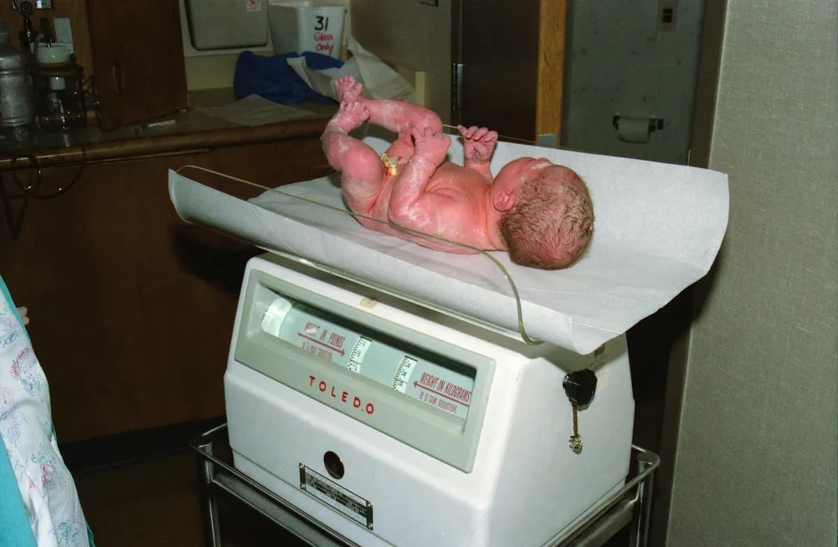 Baby's Poor Weight Gain — health symptom