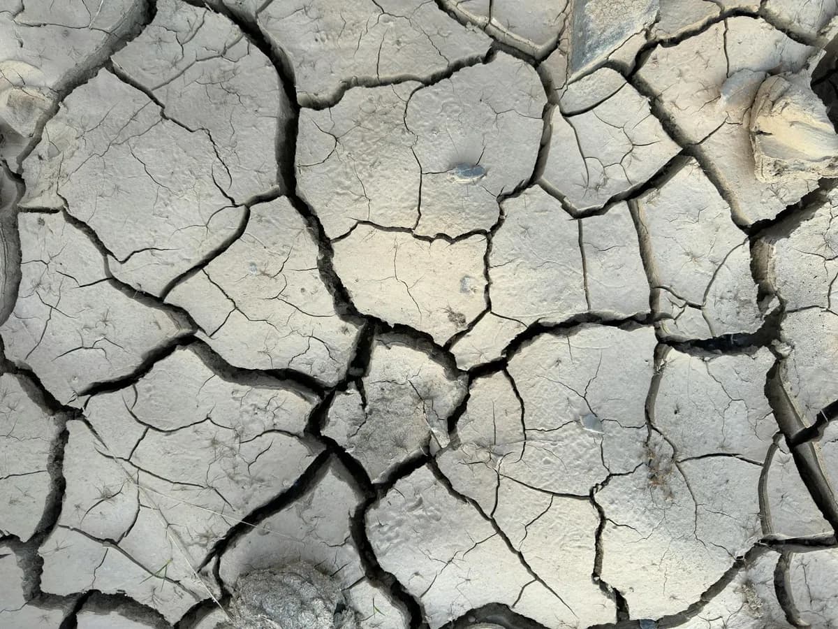 Dehydration — health symptom