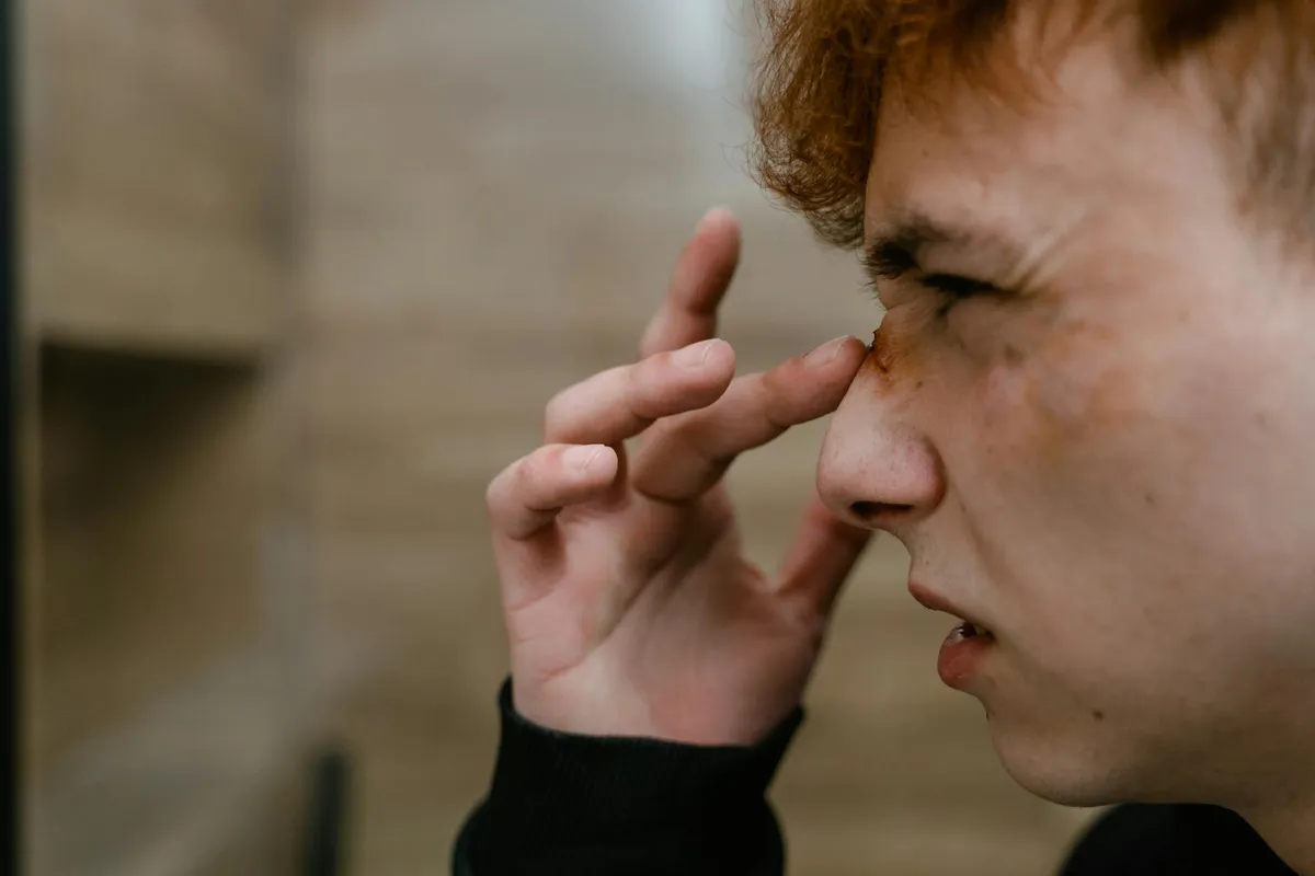 Nosebleeds — health symptom