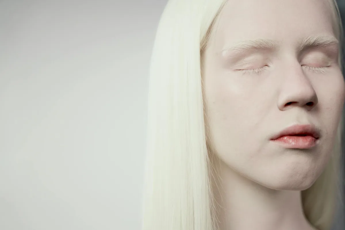 Pale Skin — health symptom
