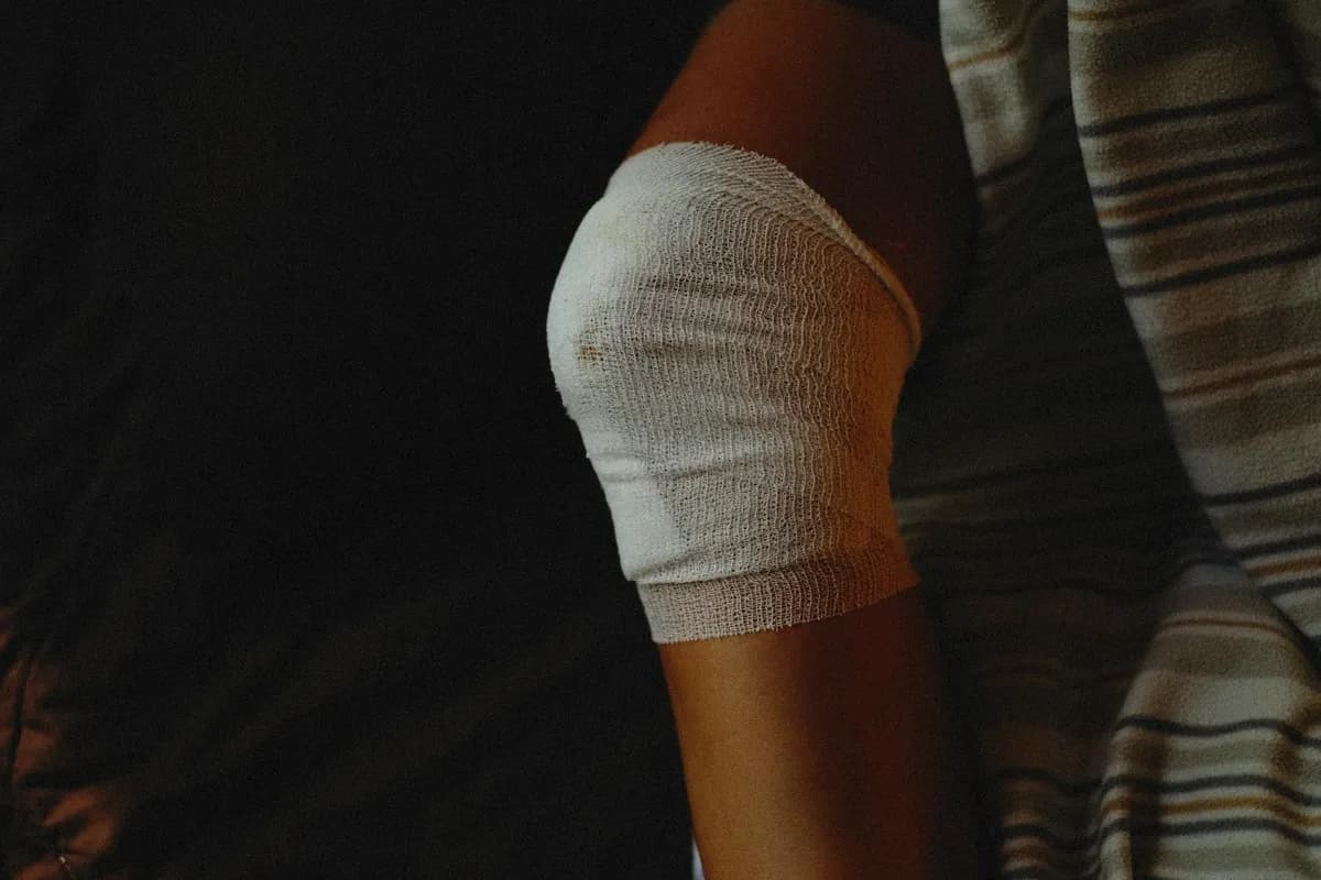 Persistent Joint Swelling — health symptom