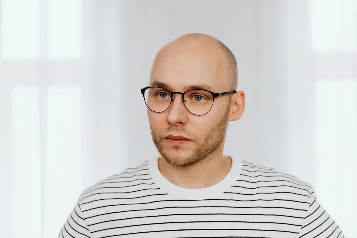 Receding Hairline — health symptom