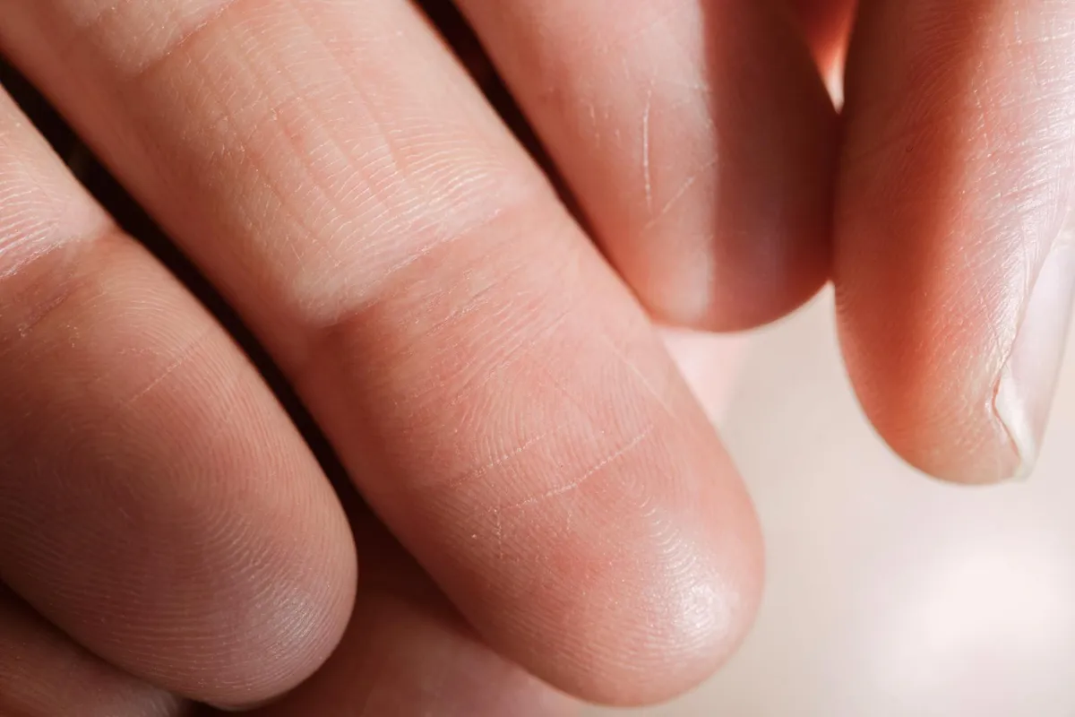 Texture Sensitivity — health symptom