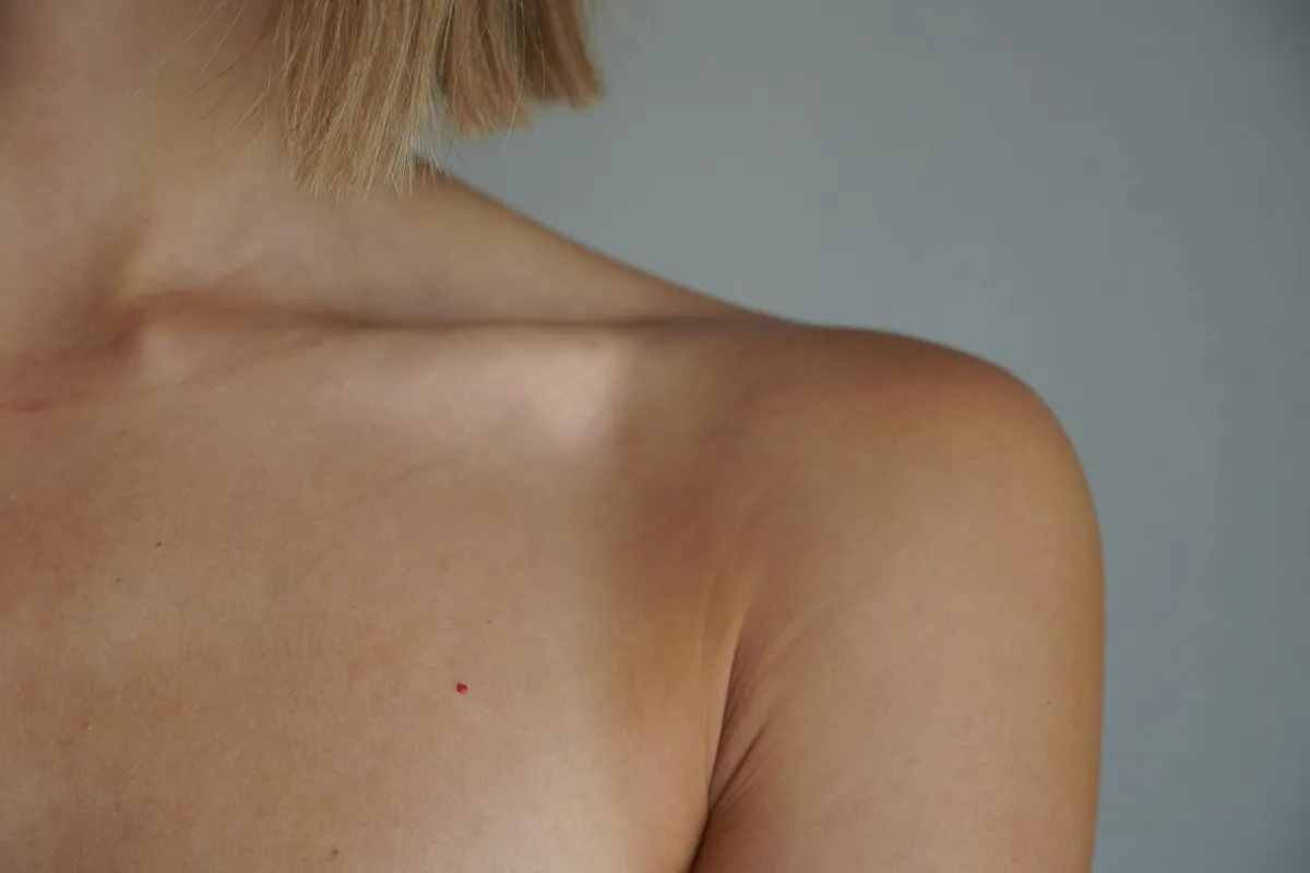 Uneven Shoulder Height — health symptom
